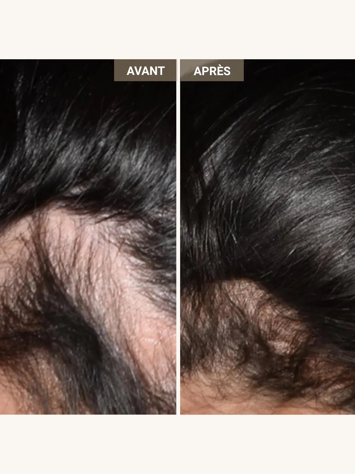 Casque LED & laser cheveux "Le Professionnel" - Image 7