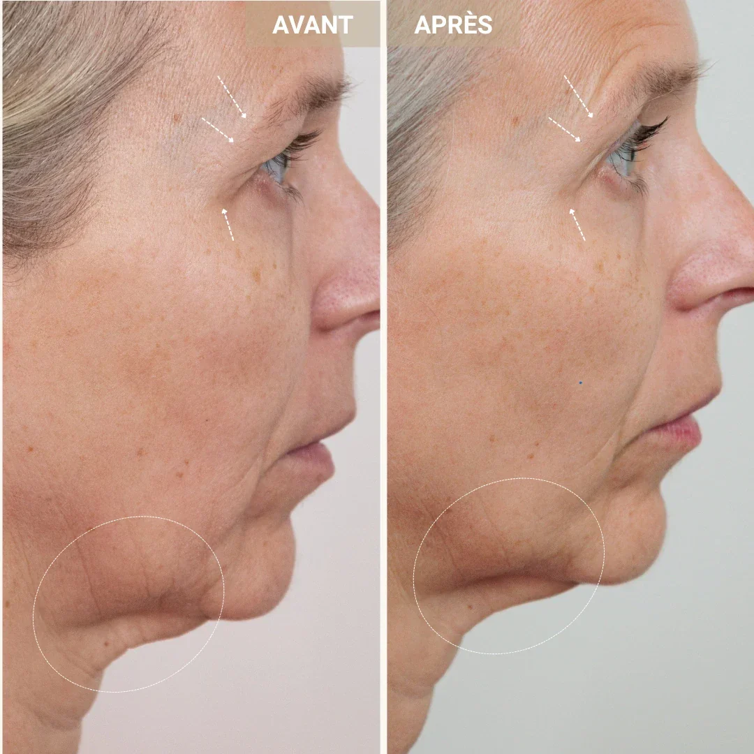 Sérum peptides de cuivre 2% - Image 6