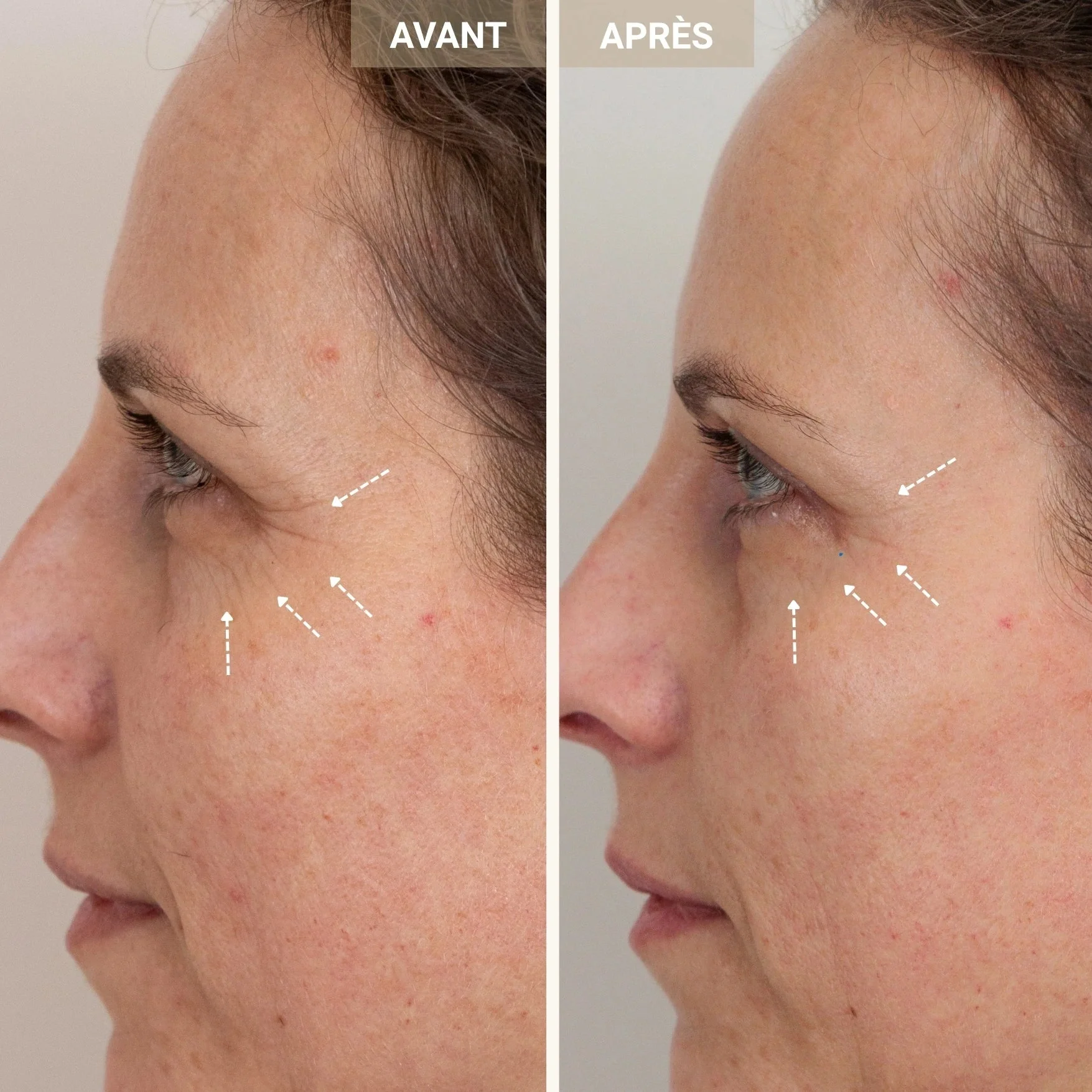 Sérum peptides de cuivre 2% - Image 8
