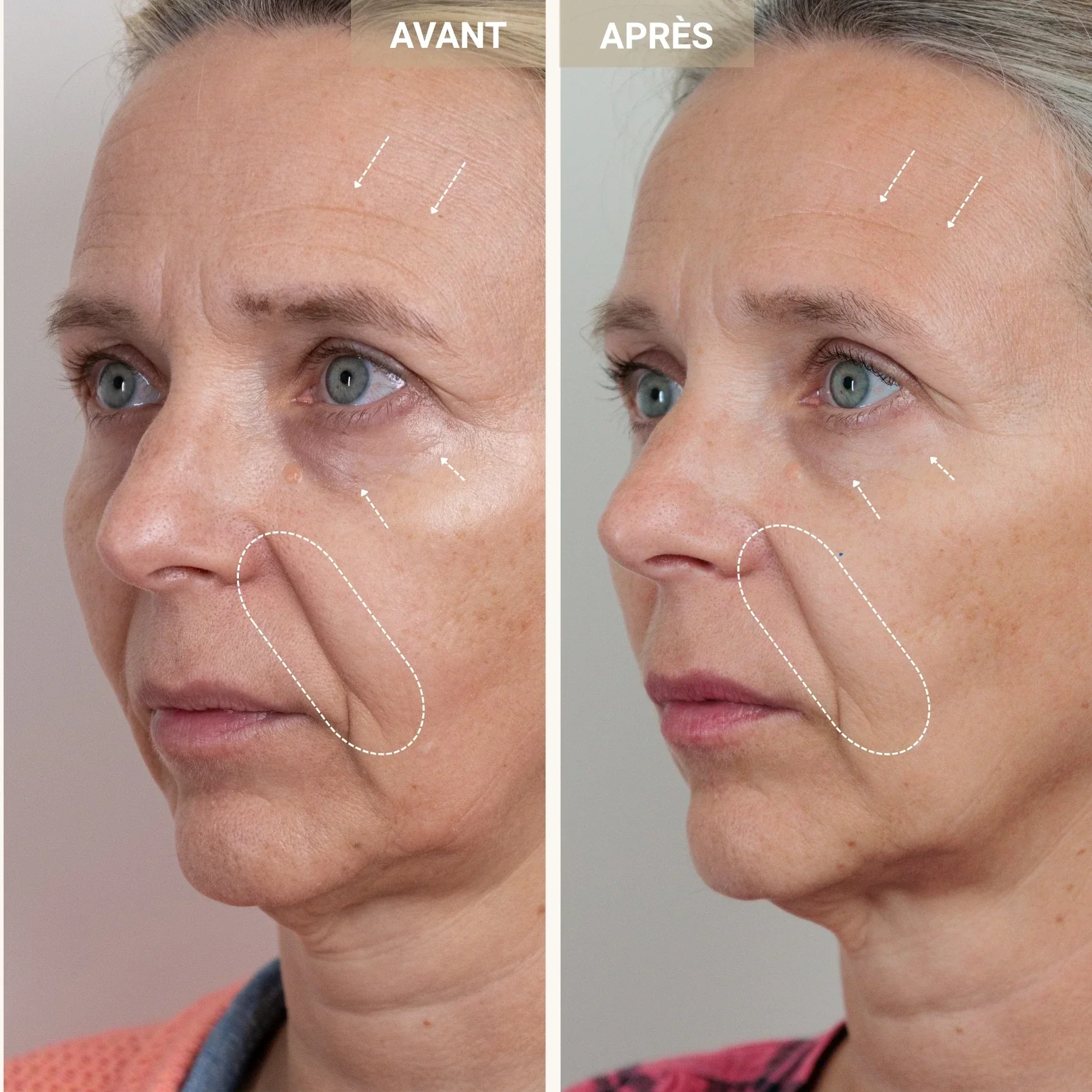 Sérum peptides de cuivre 2% - Image 9